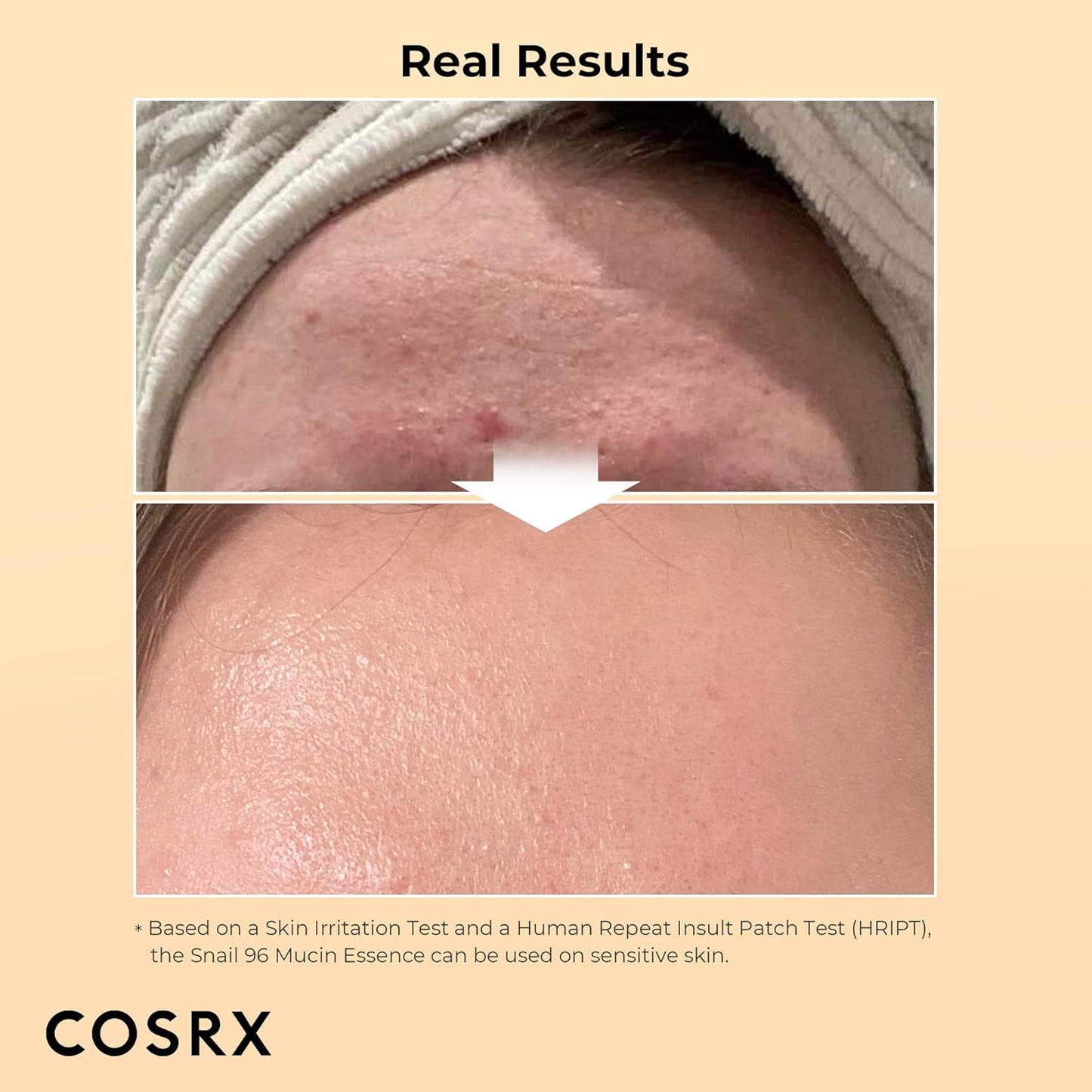 COSRX Best Seller Duo- Snail 92 Cream & Snail 96 Essence