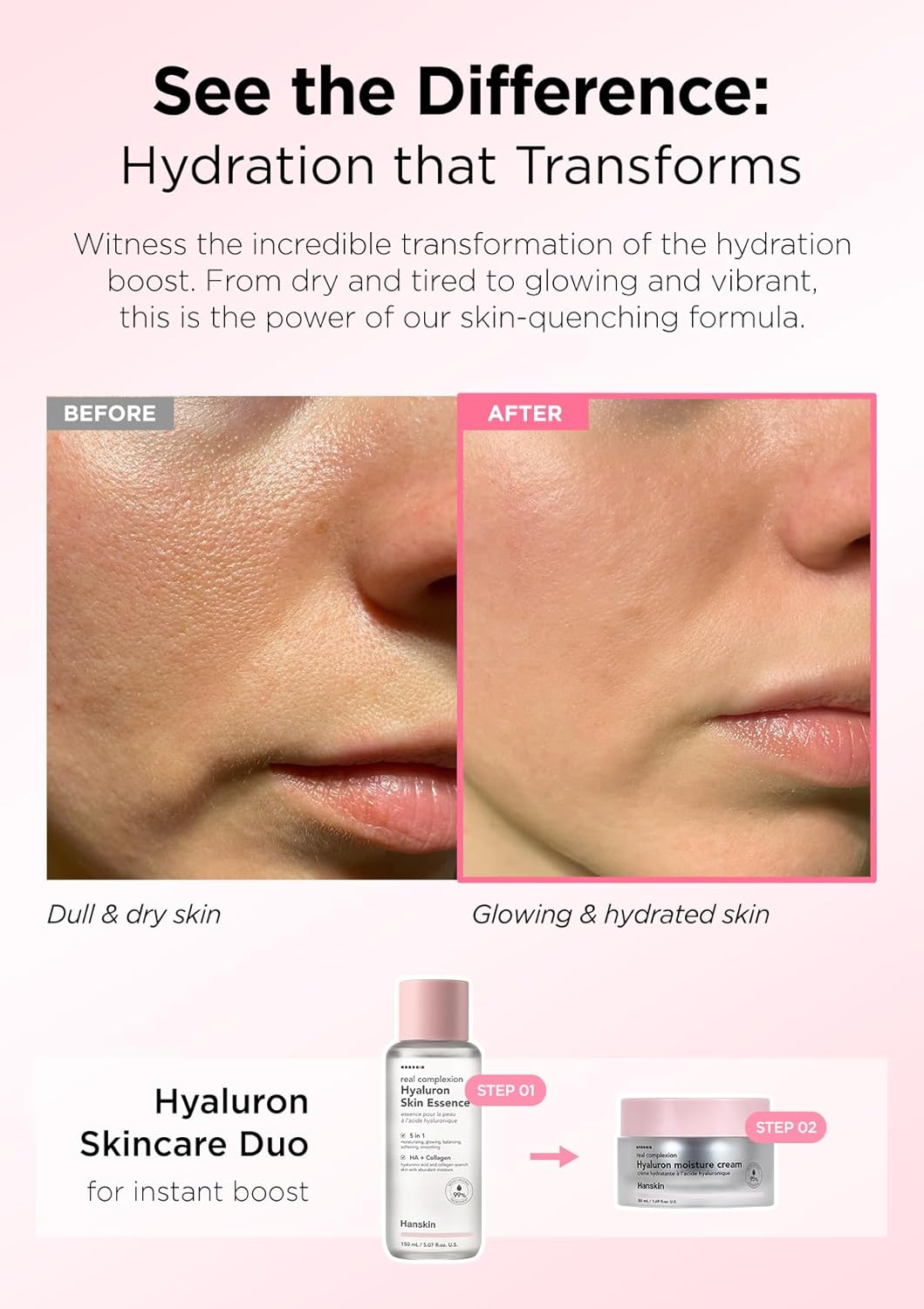 Hanskin Real Complexion Hyaluron Skin Essence [150 ml]